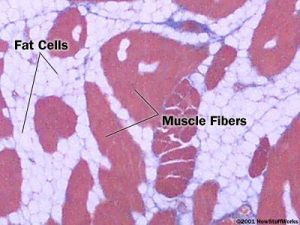 Cross-section of muscle